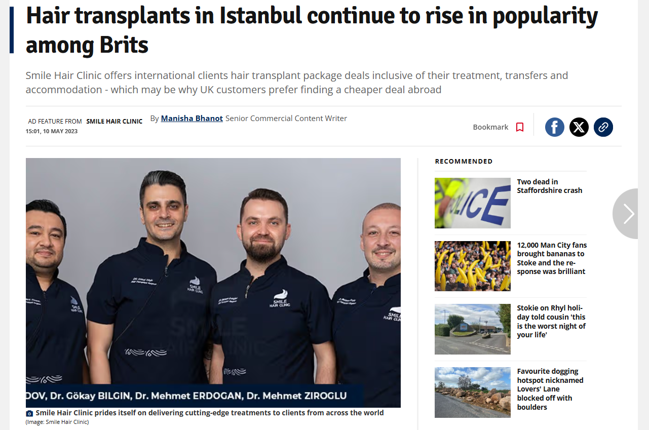 Stoke Sentinel feature showing Smile Hair Clinic doctors including Dr. Gökay Bilgin
